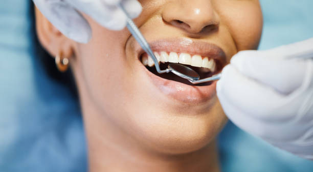 Best Knocked-Out Tooth Emergency  in Woodacre, CA
